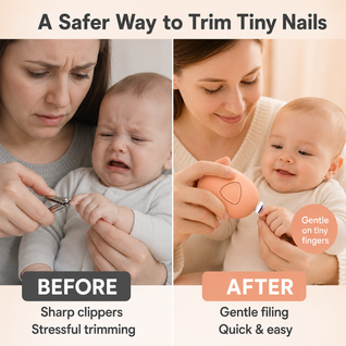 TinyEase™ Baby Nail Trimmer — Safe Electric Filer for Newborns & Toddlers